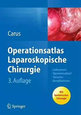 Couverture du produit · Operationsatlas Laparoskopische Chirurgie: Indikationen - Operationsablauf - Varianten - Komplikationen