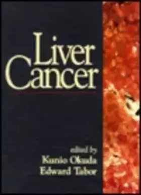 Couverture du produit · Liver Cancer