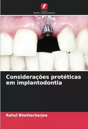Couverture du produit · Considerações protéticas em implantodontia (Portuguese Edition)