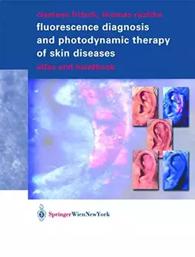 Couverture du produit · Fluorescence Diagnosis and Photodynamic Therapy of Skin Diseases: Atlas and Handbook