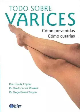 Couverture du produit · Todo sobre varices / Everything about Varicose Veins: Como prevenirla, Como curarla/ How to prevent them, How to cure them (Spa