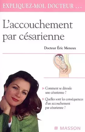 Couverture du produit · L'accouchement par césarienne