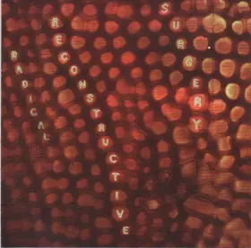 Couverture du produit · Scotty Hard's Radical Reconstructive Surgery