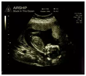 Couverture du produit · Stuck in This Ocean-Digi [Import]