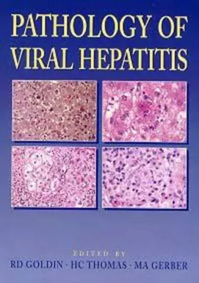 Couverture du produit · Pathology of Viral Hepatitis