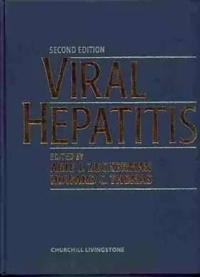 Couverture du produit · Viral Hepatitis