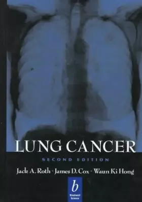 Couverture du produit · Lung Cancer