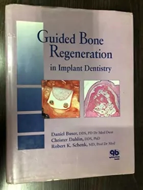 Couverture du produit · Guided Bone Regeneration in Implant Dentistry
