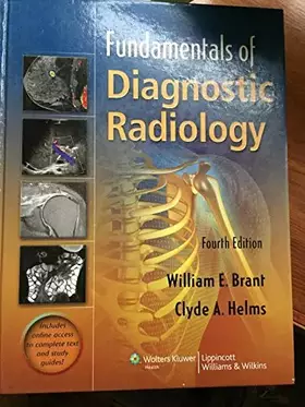 Couverture du produit · Fundamentals of Diagnostic Radiology