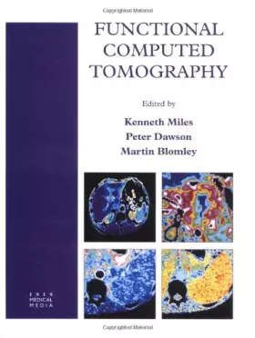 Couverture du produit · Functional Computed Tomography