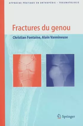 Couverture du produit · Fractures du genou