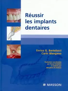 Couverture du produit · Réussir les implants dentaires
