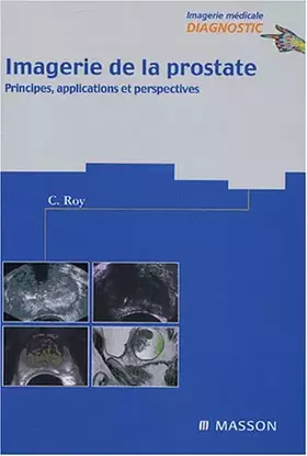 Couverture du produit · Imagerie de la prostate : Principes, applications et perspectives