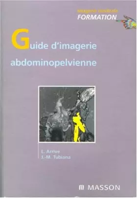 Couverture du produit · Guide d'imagerie abdomino-pelvienne