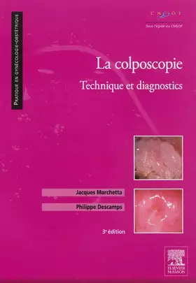 Couverture du produit · La colposcopie: Technique et diagnostics