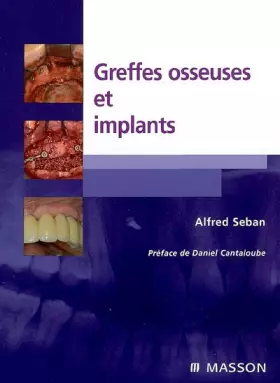 Couverture du produit · Greffes osseuses et implants