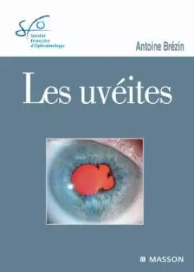 Couverture du produit · Les uvéites: Rapport SFO 2010