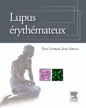 Couverture du produit · Lupus érythémateux