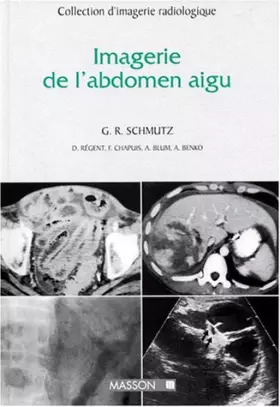 Couverture du produit · Imagerie de l'abdomen aigu