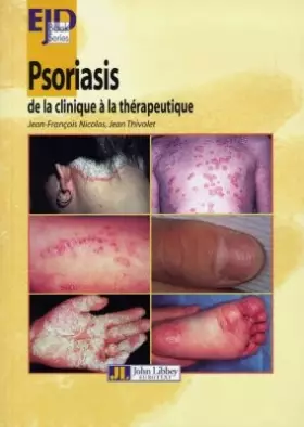 Couverture du produit · Psoriasis : De la clinique à la thérapeutique
