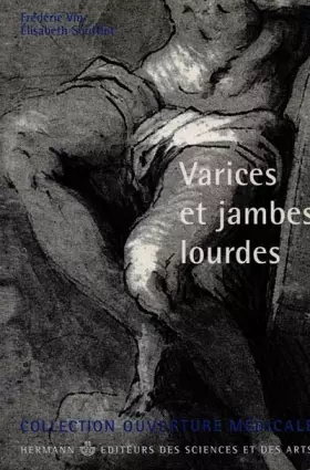 Couverture du produit · Varices et jambes lourdes