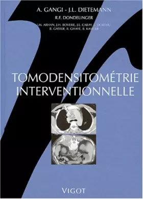 Couverture du produit · Tomodensitométrie interventionnelle