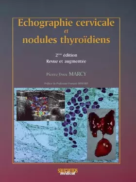 Couverture du produit · ECHOGRAPHIE CERVICALE ET NODULES THYROIDIENS (0000)