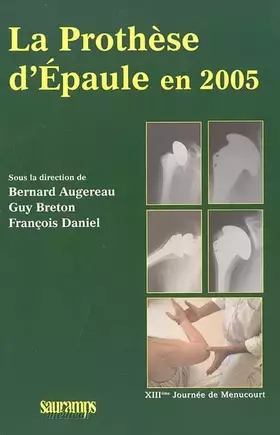 Couverture du produit · LA PROTHESE D EPAULE EN 2005