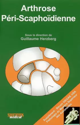 Couverture du produit · ARTHROSE PERI SCAPHOIDIENNE