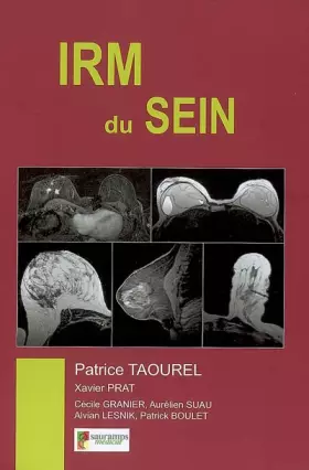 Couverture du produit · IRM du sein