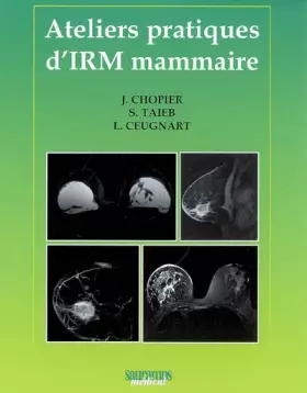 Couverture du produit · ATELIERS PRATIQUES D IRM MAMMAIRE