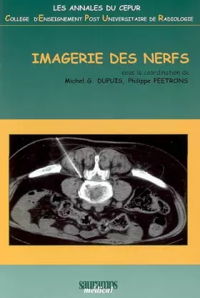 Couverture du produit · IMAGERIE DES NERFS CEPUR