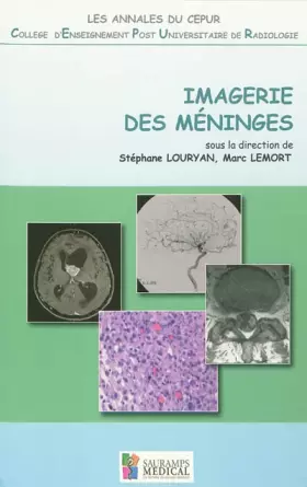 Couverture du produit · IMAGERIE DES MENINGES - ANNALES DU CEPUR