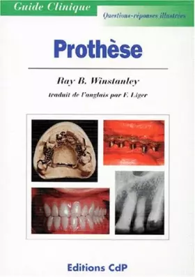 Couverture du produit · PROTHESE