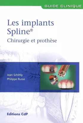 Couverture du produit · Les Implants Spline® : Chirurgie et prothèse