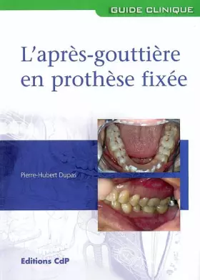 Couverture du produit · L'après-gouttière en prothèse fixée