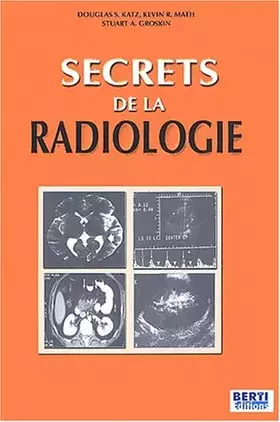 Couverture du produit · Secrets de la radiologie