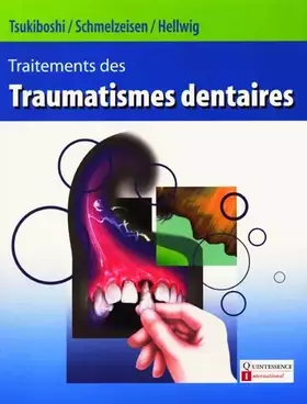 Couverture du produit · Traitement des traumatismes dentaires
