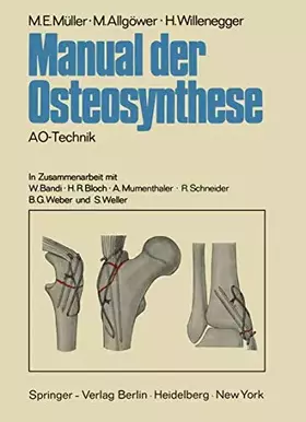 Couverture du produit · Manual der Osteosynthese: AO-Technik (German Edition)