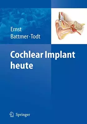 Couverture du produit · Cochlear Implant heute (German Edition)