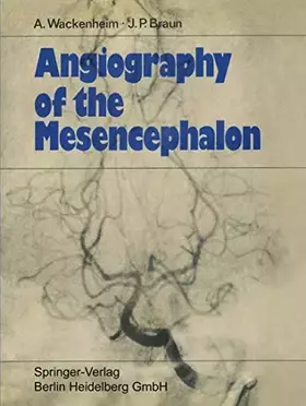 Couverture du produit · Angiography of the Mesencephalon