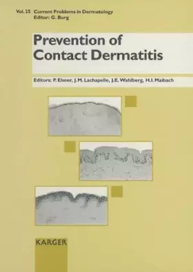 Couverture du produit · Prevention of Contact Dermatitis