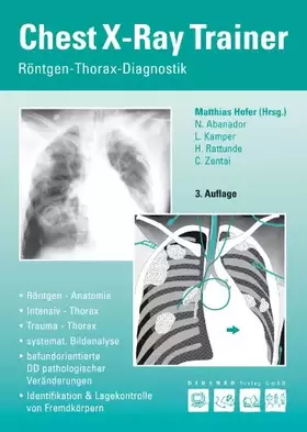 Couverture du produit · Chest-X-Ray-Trainer: Röntgen-Thorax-Diagnostik